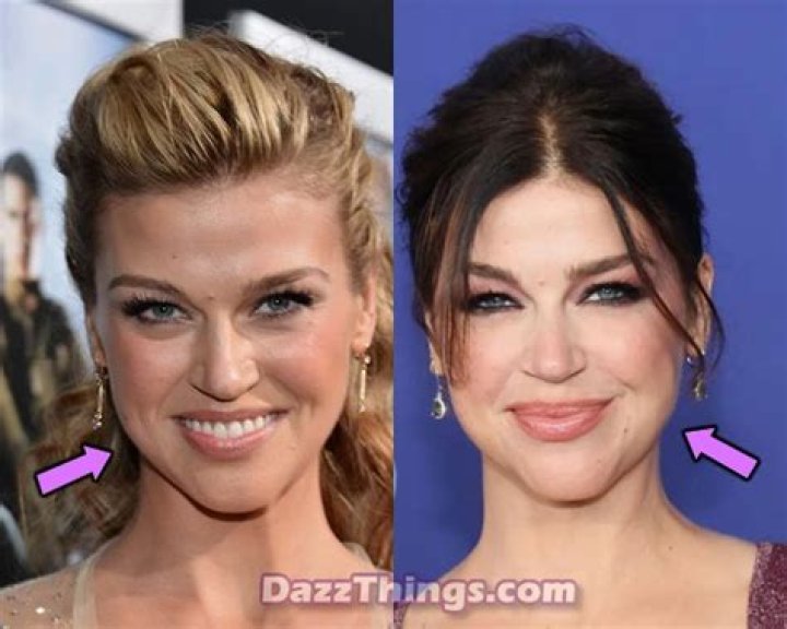 Adrianne Palicki Plastic Surgery Before and After