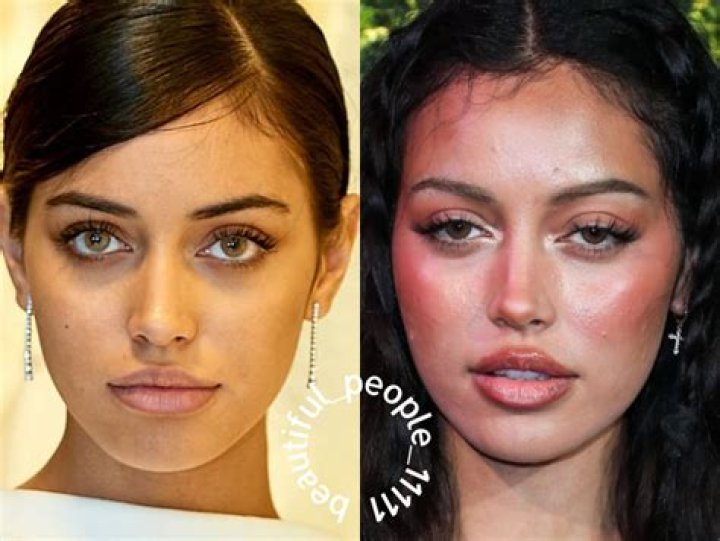 cindy kimberly plastic surgery 