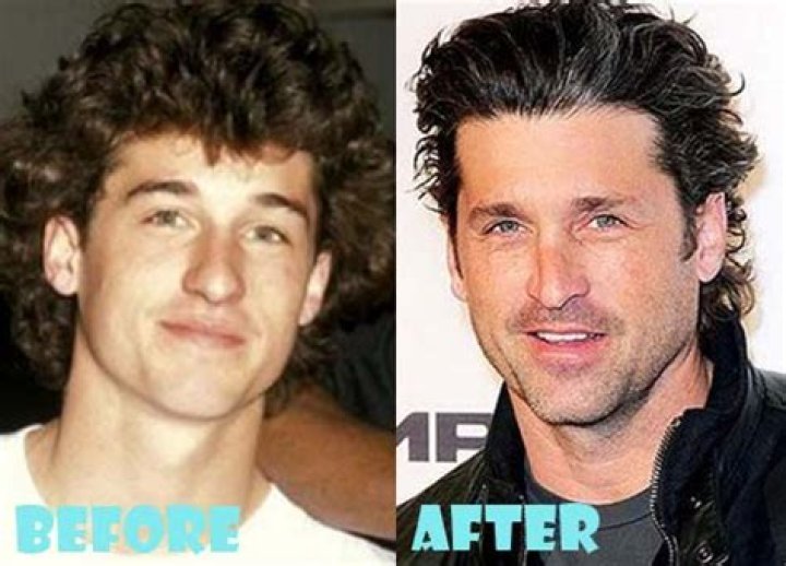 Patrick Dempsey Plastic Surgery Before and After